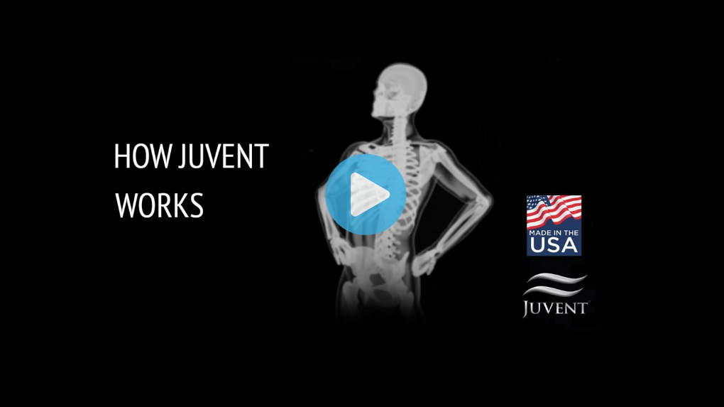 Load video: How Juvent Works